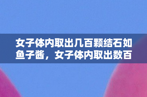 女子体内取出几百颗结石如鱼子酱图片